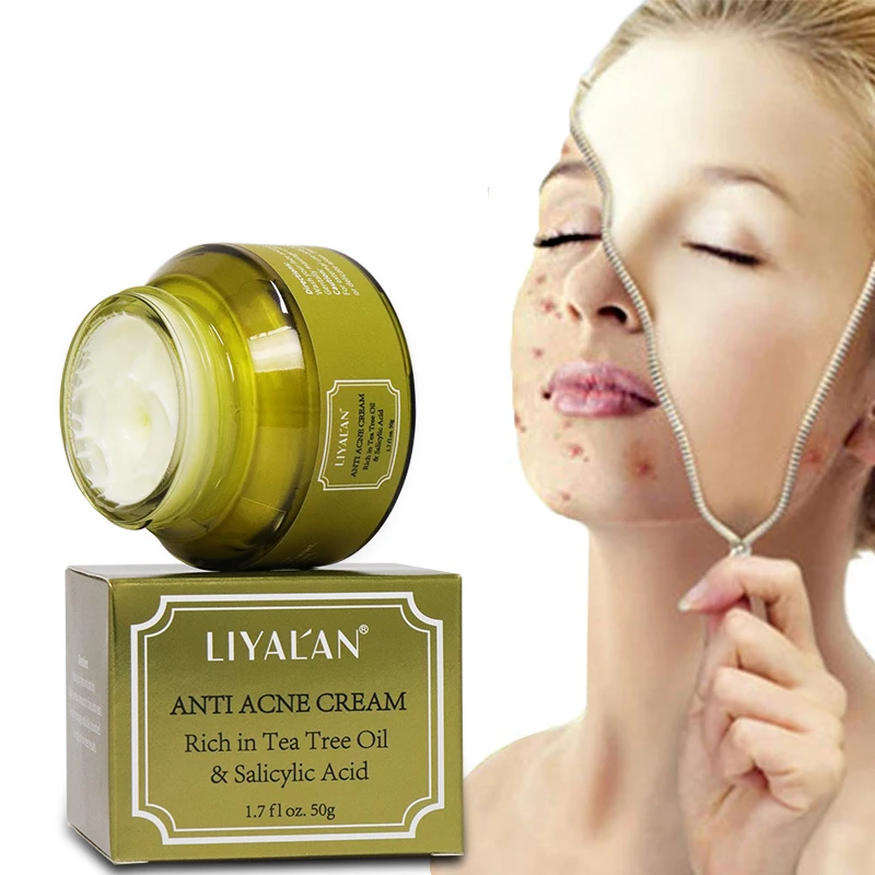 

Factory wholesale private label green tea formula 2% salicylic acid face whitening spot anti acne cream