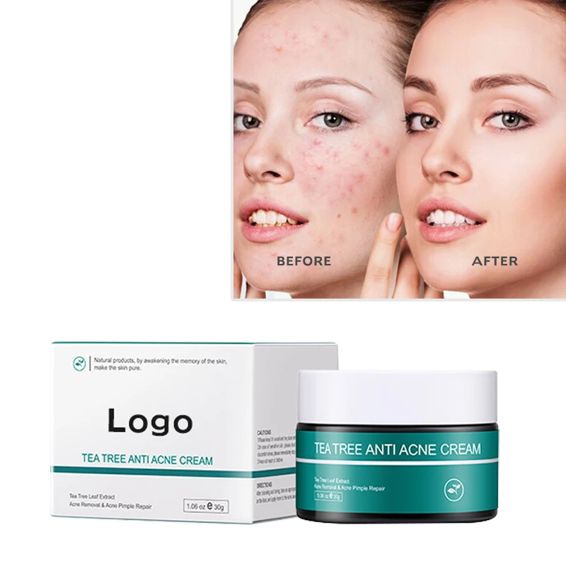 

OEM Natural Acne Scar Removal Cream Cremas Faciales Tea Tree Facial Cream Skin Care Moisturizing Cuidado De La Piel Face Cream