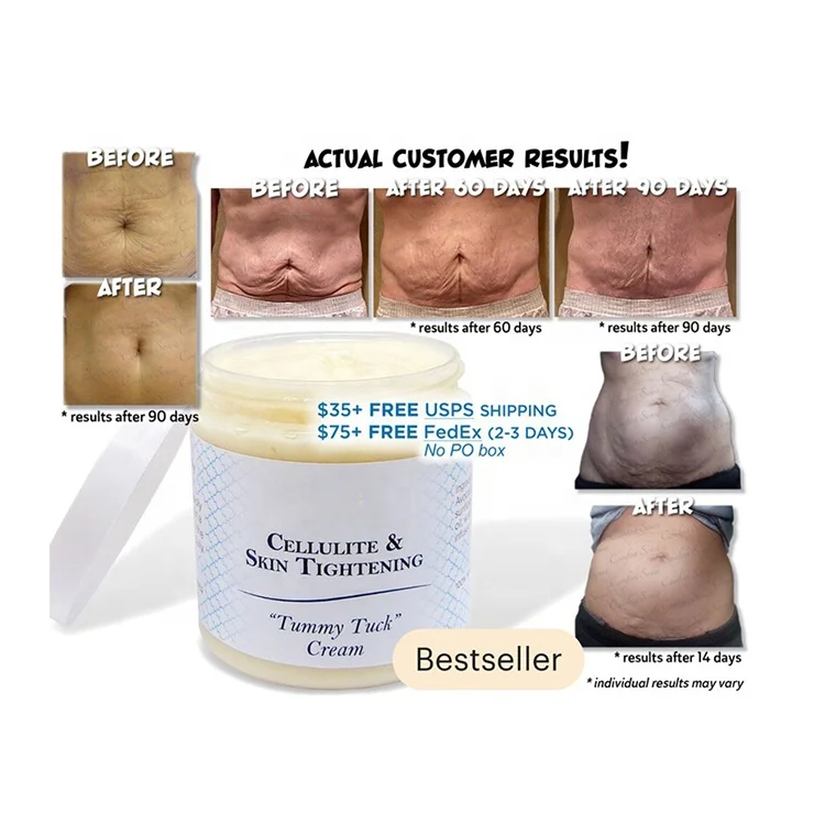 

Organic Body Cellulite and Stretch Mark Cream Tummy Tuck Tightening Stretch Mark Removal Cream