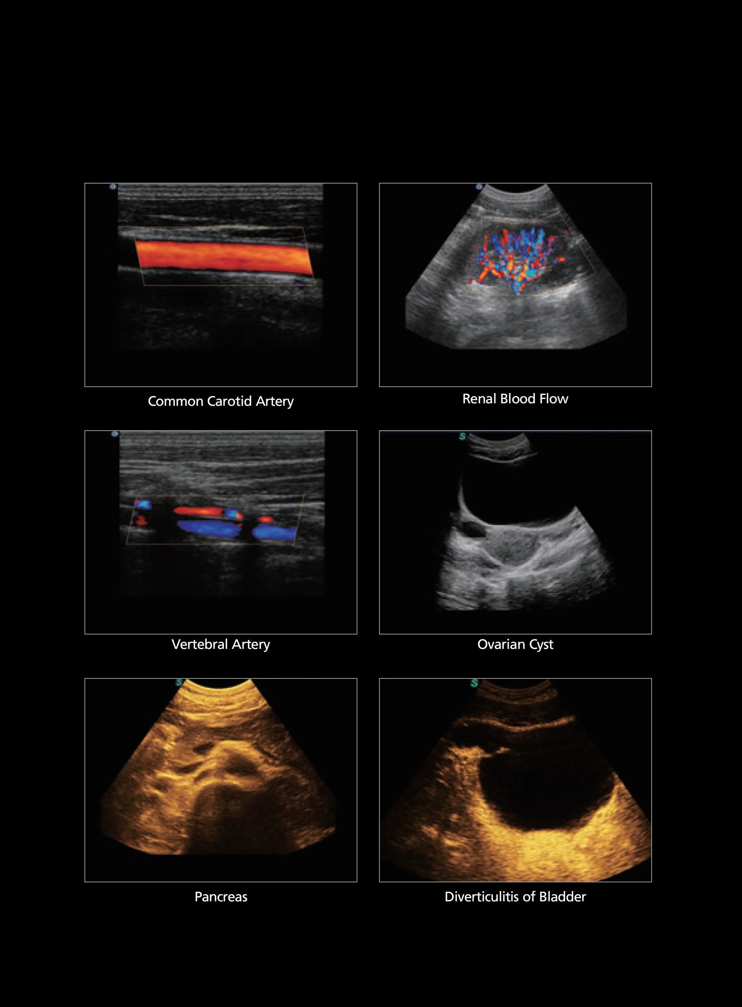 Sonoscape S11 Trolley Color Doppler Ultrasound system USG 15-inch High-Resolution Color LCD