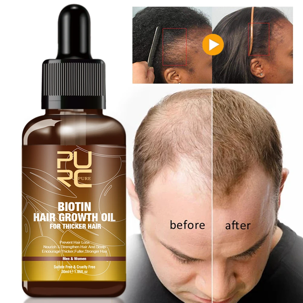 

Wholesale Men Women Natural Hair Oil Private Label Hair Growth Oil Organic Hair Regrowth Oil Serum