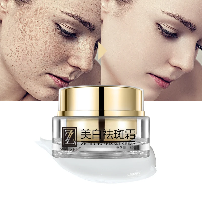 

Best Korean Anti Freckles Beauty Skin Care Anti-Aging Face Cream Moisturizer Whitening Freckle Removing Cream, Gold