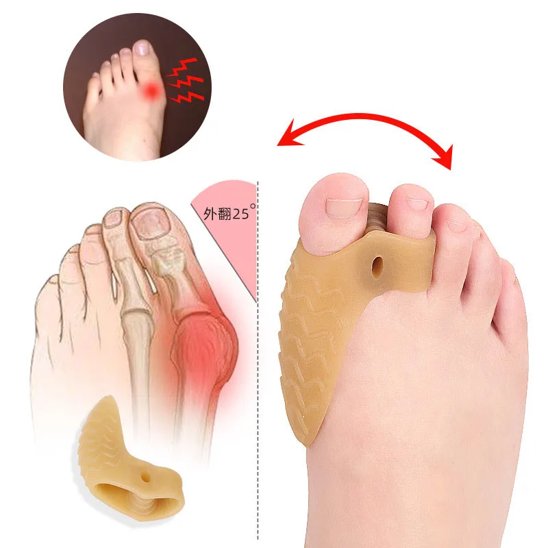 

Hallux Valgus Splints Bunion Corrector Toes Protector Pain Relief Hallux Valgus Foot Care Pedicure Orthotics, Yellow