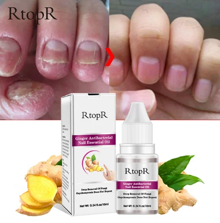 

RTOPT Fungal Nail Treatment Whitening Ginger Nail Essential Oil