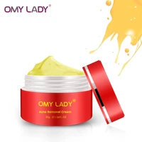 

Omy Lady Moisturizer Skincare Products Remove Pimple Cream Face Acne Scar Removal Cream acne cream whitening