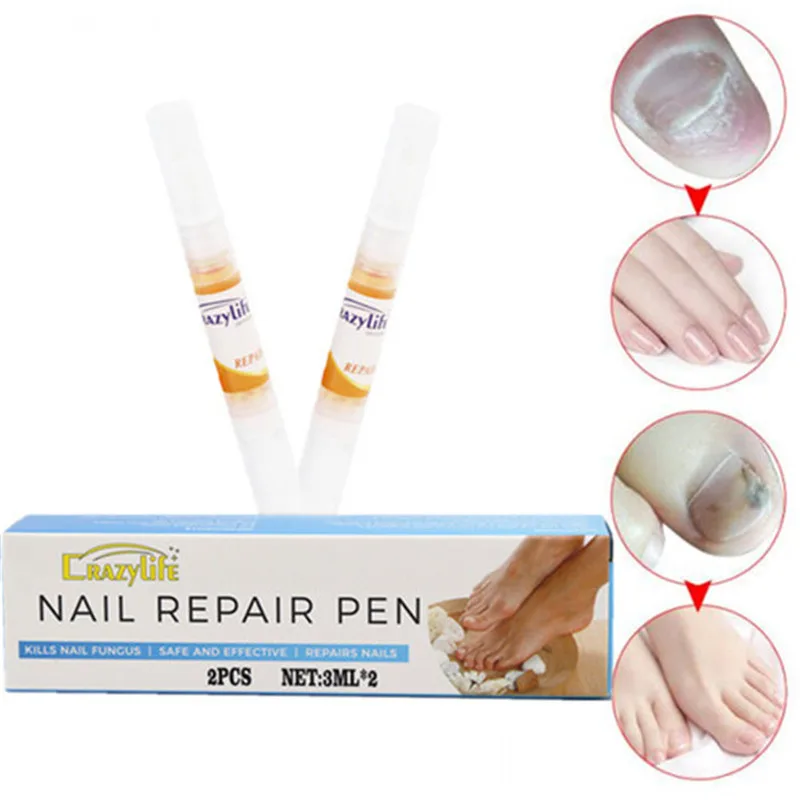

3ML Anti Fungal Treatment Nail Pen Onychomycosis Paronychia Infection Herbal Toe Finger Repair Nails Health Beauty Tool
