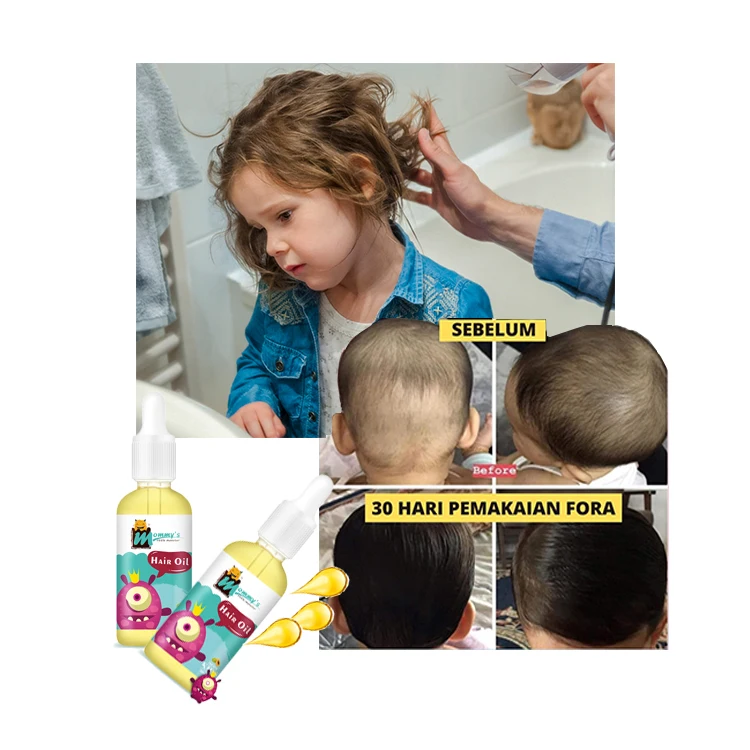 

MOMMY'S LITTLE MONSTER Private Label Moisture Nourish Organic Hair Growth Oil With Biotin For Kids