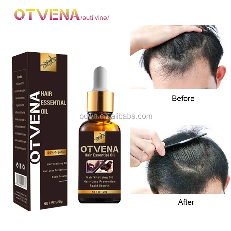 

OTVENA Herbal Instant Hair Grow Spray For Faster Hair Growth