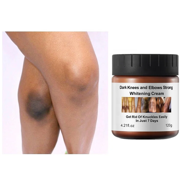 

Private Label Dark Knees and Elbows Strong Whitening Cream Fast Action Extreme Whitening Cream