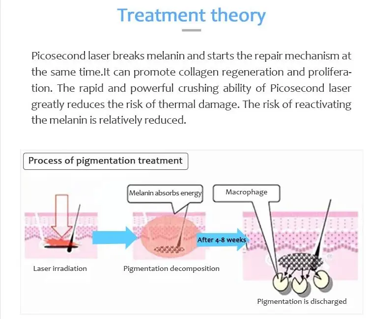 2021 New Arrival Vertical Picosecond Acne Pock Mark Wrinkle Removal Beauty Device with best feedback