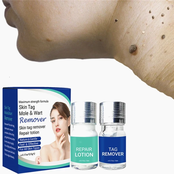 

Skin Tag Remover Against Mole & Genital Wart fast RemovWithin al Anti Foot Corn Removal Warts Papillomas Rapidly removes moles