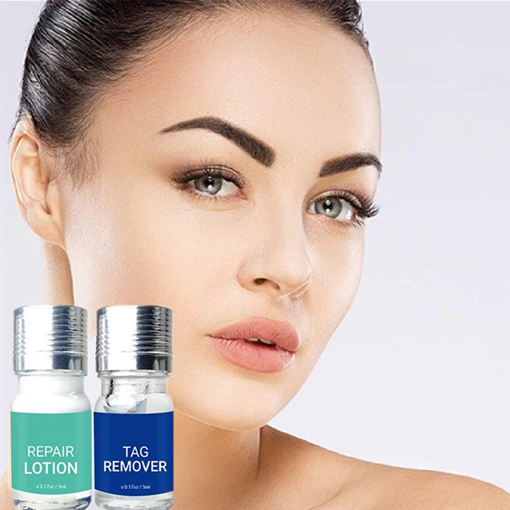 

Skin Tag Remover Exfoliante Serum Beauty Moisturizer moles and skin tags remover