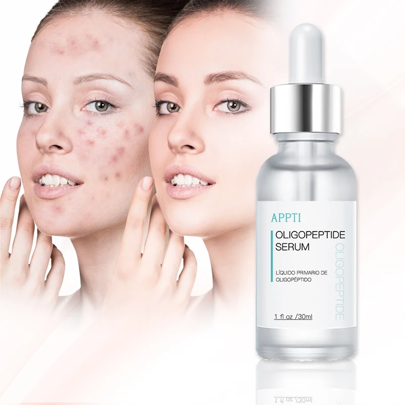 

Free Sample Nourishing Moisturizing Skin Care Anti Acne Serum Private Label Oligopeptide Serum for Repair Skin Remove Acne