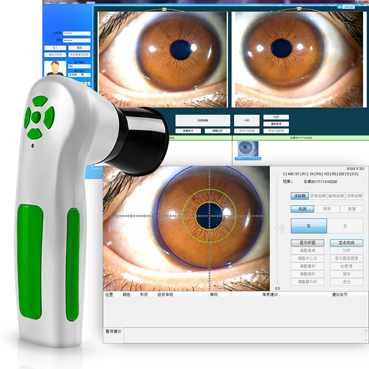 

Portable Iriscope Iridology Camera Eye Iriscope Analyzer Software Iris Analyzer