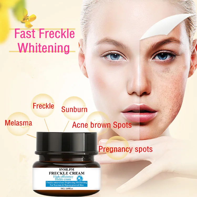 Snmlpm 30g Freckle Cream Deep Moisturizing Melanin Freckle Cream Dark ...