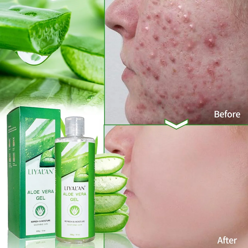 

Manufacturer Wholesale Organic Natural Scar Acne Removal Alovera Gel 100% Pure Soothing Aloe Vera Gel For Face