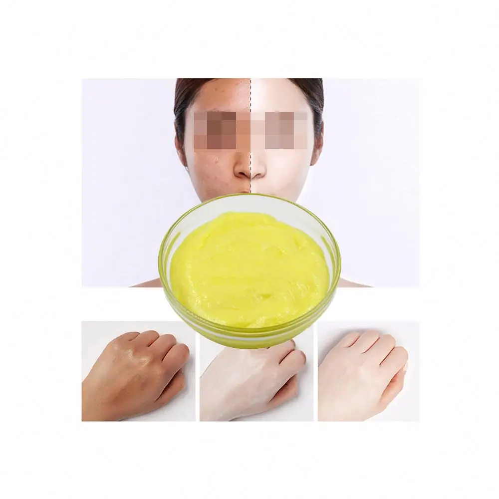 

Dark Under Arm Whiter Dark Spot around Neck Half Caste Cream Dark Knuckle Eraser Semi-finished products Sold by Weight