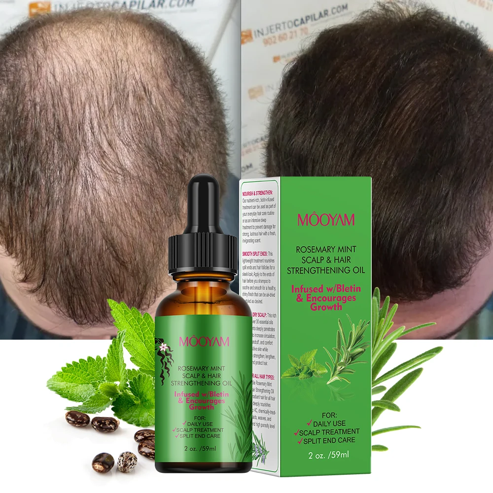 

Rosemary Mint Scalp &Hair Strengthening Oil 100% Pure Nature Organic Fast Effective Hair Growth Oil