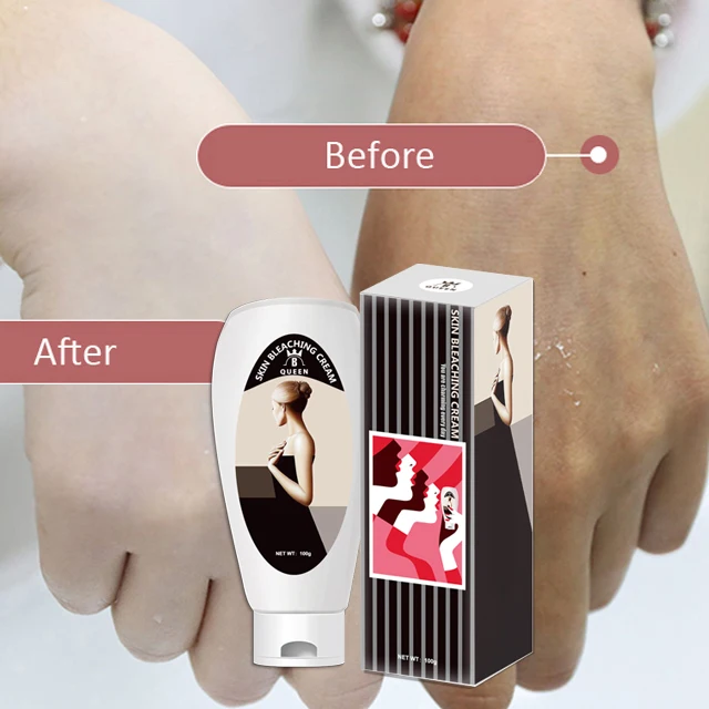 strong bleaching cream