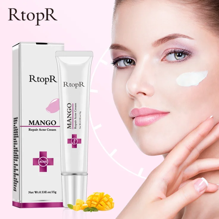 

Hot sale Mango acne and pimples treatment cream anti acne scar removal cream, Milk white