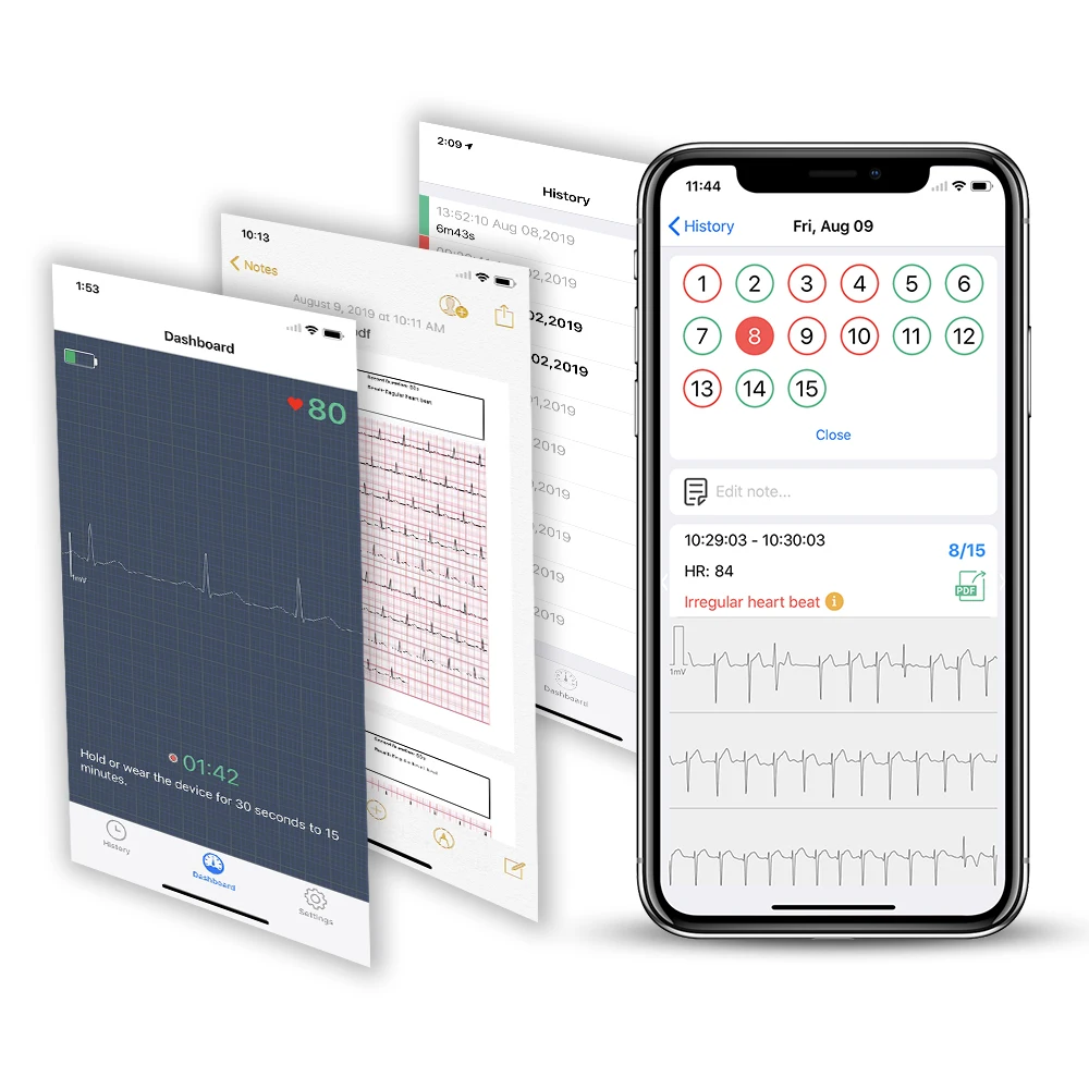 Wellue Duoek Wireless Ecg Machine Portable Handheld Ekg Monitor - Buy ...