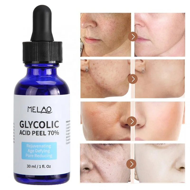 

Bulk Cosmetic Grade Natural Pure Skincare Glycolic Acid 70% Liquid Facial Peel Serum for Ance Anti-aging Skin Rejuvenation