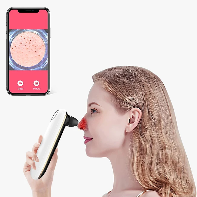 

Remove Blackhead Visual Instrument Visible Black Head Visual Vacuum Blackhead Remover With Camera