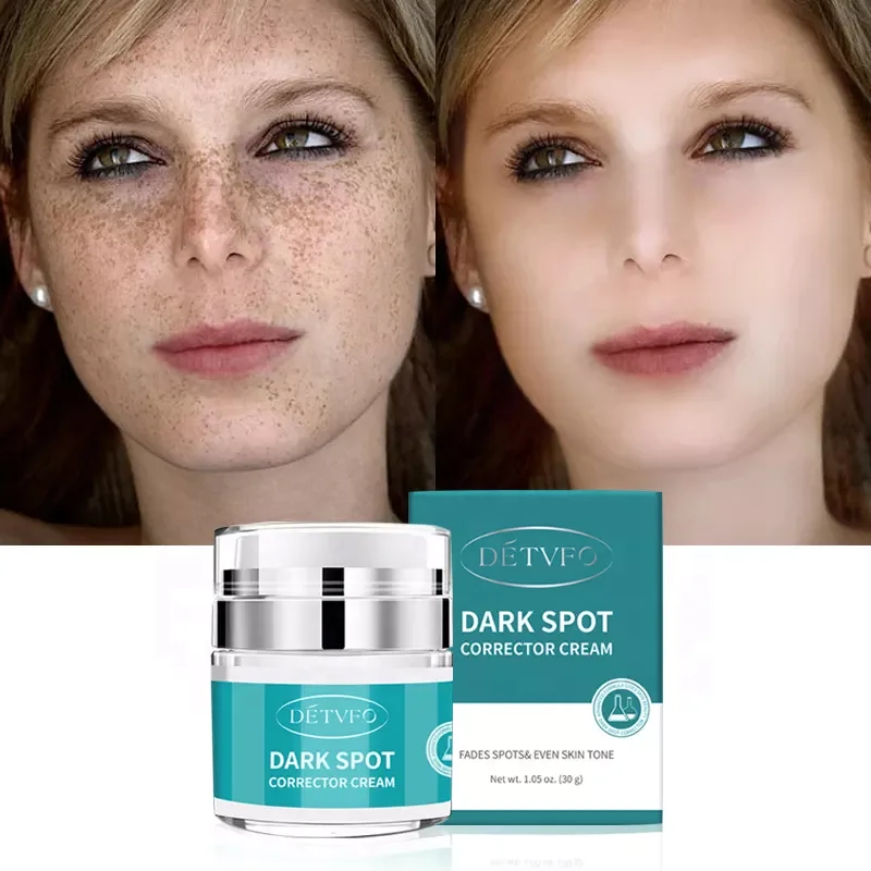 

Face Whitening Freckle Remove Remover Lactic Acid Brightening Dark Spot Corrector Cream For Men Women