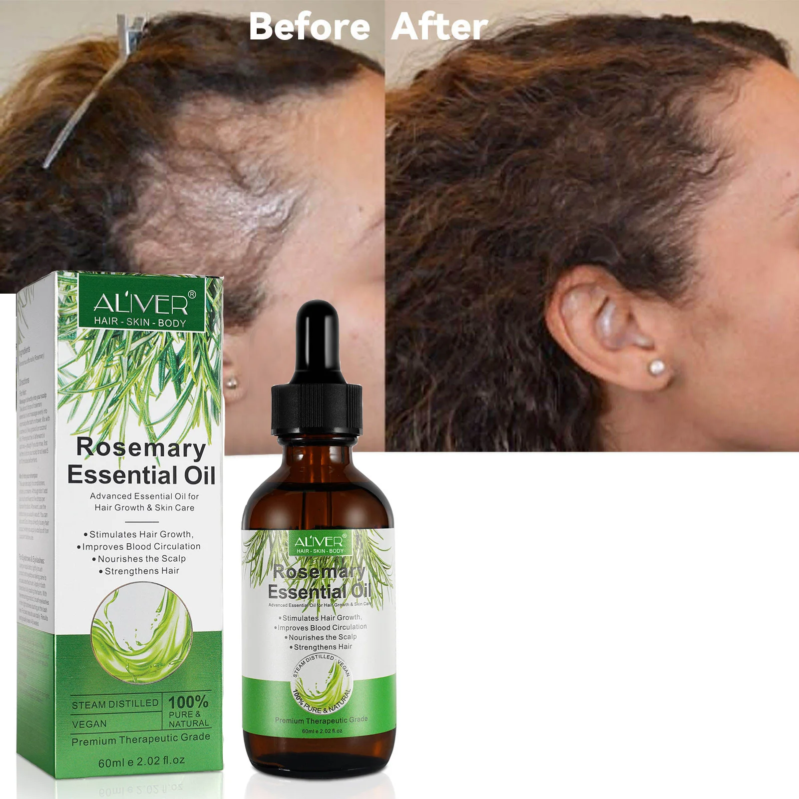 

ALIVER Scalp Care Hair-Repairing Nourishing Wholesale 100% Pure Natural Organic Rosemary Essential Oil for Hair Growth