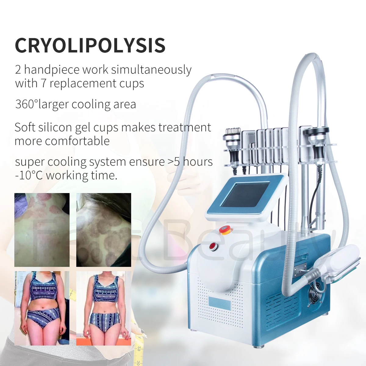 

Portable Cryoslim Cryotherapy slimming Fat Freezing lipolaser Vacuum Cavitation System Criolipolisis Machine