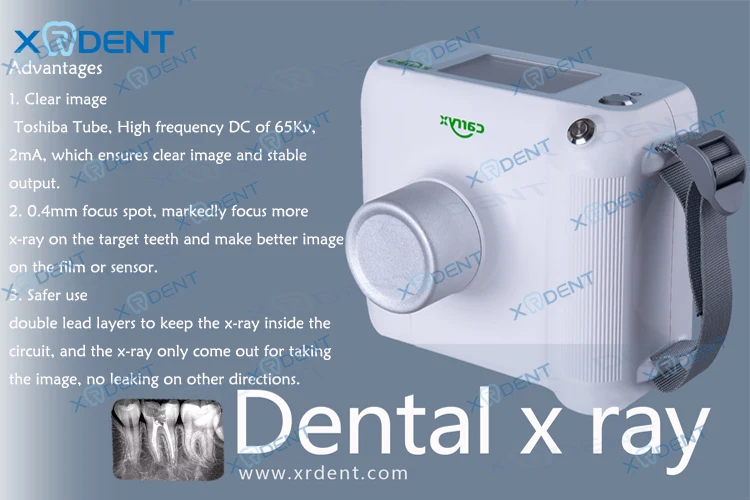 Clear Image Carry.x Dental Digital Portable X Ray Equipment Buy