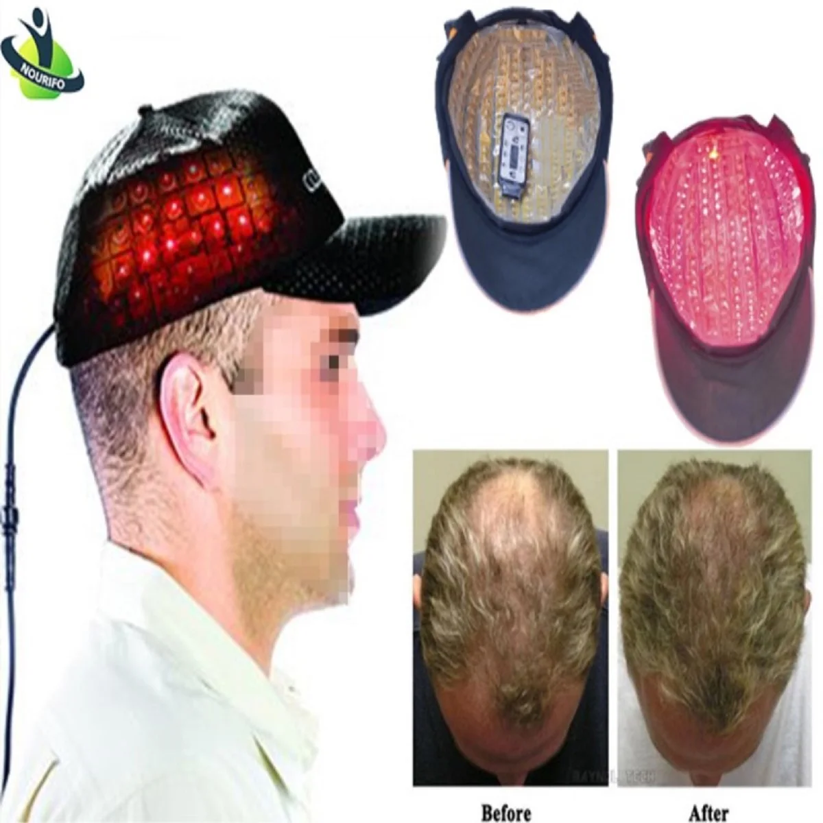 

Amazon top sale hair growth helmet 276 diodes laser helmet for hair loss, Black