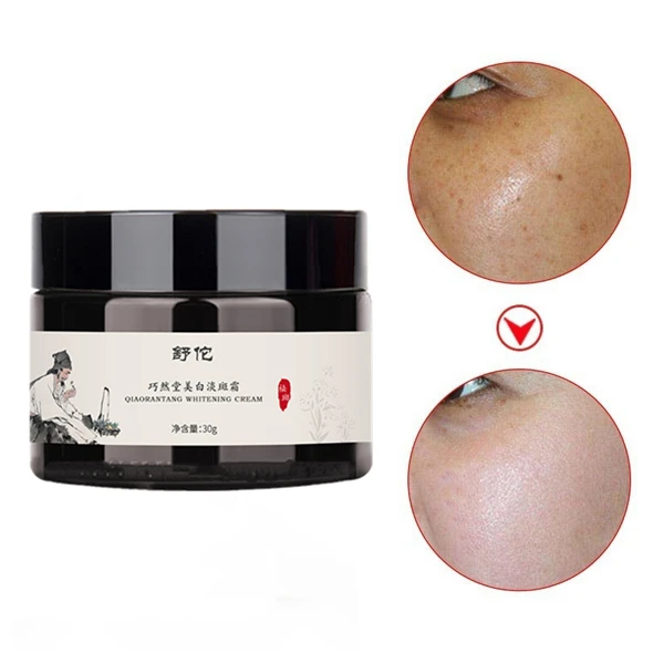 

Organic Face Removing Pigmentation Best Bleaching Black Skin Whitening Fade For Dark Spots Removal Freckle Cream