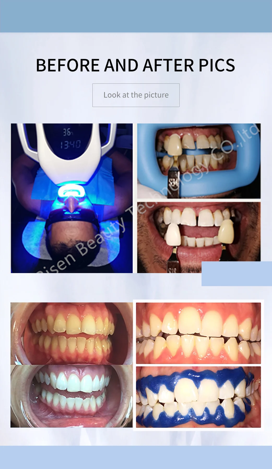 teeth whitening machine