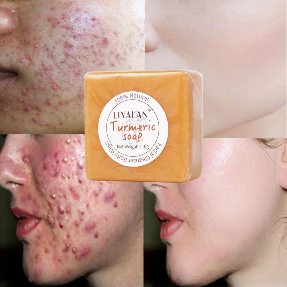 

Wholesale 100 % Natural Organic Herbal Savon Tumeric Soap Anti Acne Remove Pimples Ginger Handmade Turmeric Soap