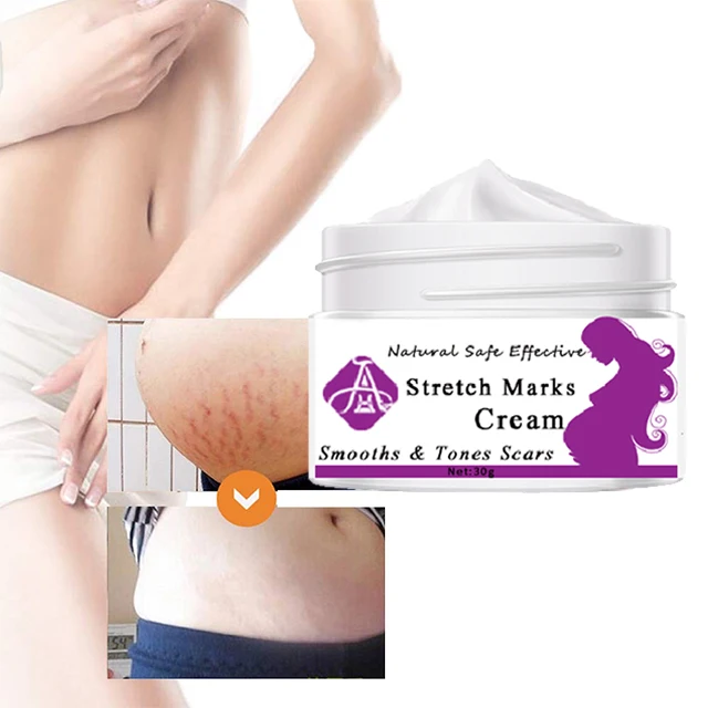 

AH Best Body Moisturizer Natural Ingredients Reduce Obesity Lines Stretch Marks Scar Removal Cream