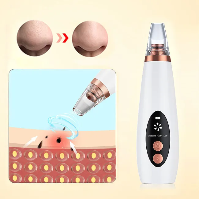

Bubble Pore Vacuum suction remove device blackhead Acne White Heads Cleaner with 6 Suction Head