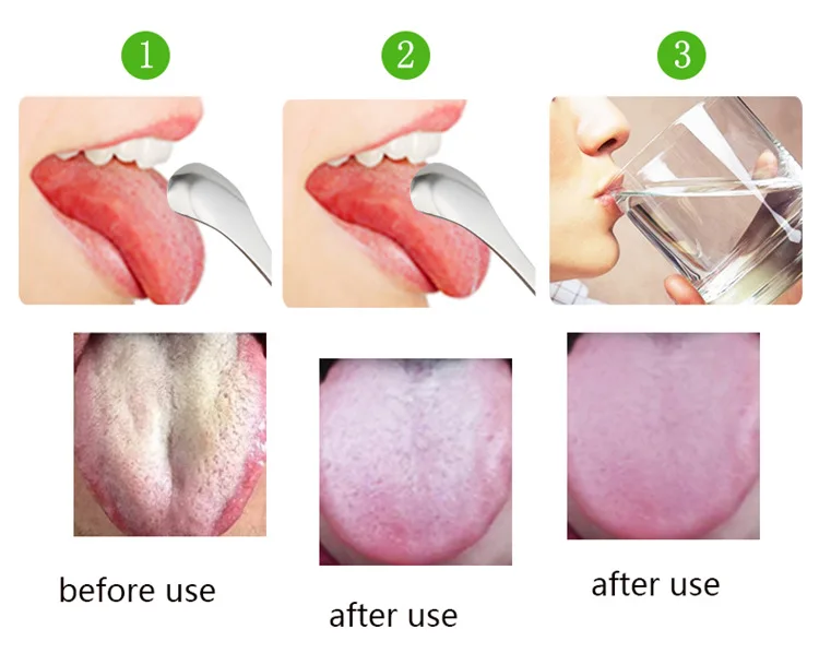 tongue cleaner (5).jpg