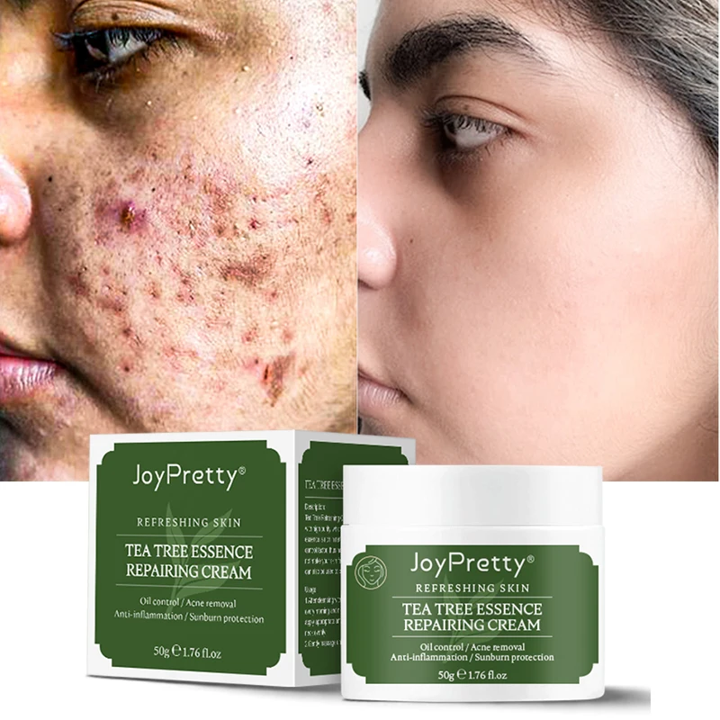 

Korean Cosmetics Acne And Pimples Treatment Face Cream Natural Tea Tree Whitening Moisturizer Facial Beauty Skin Care Cream
