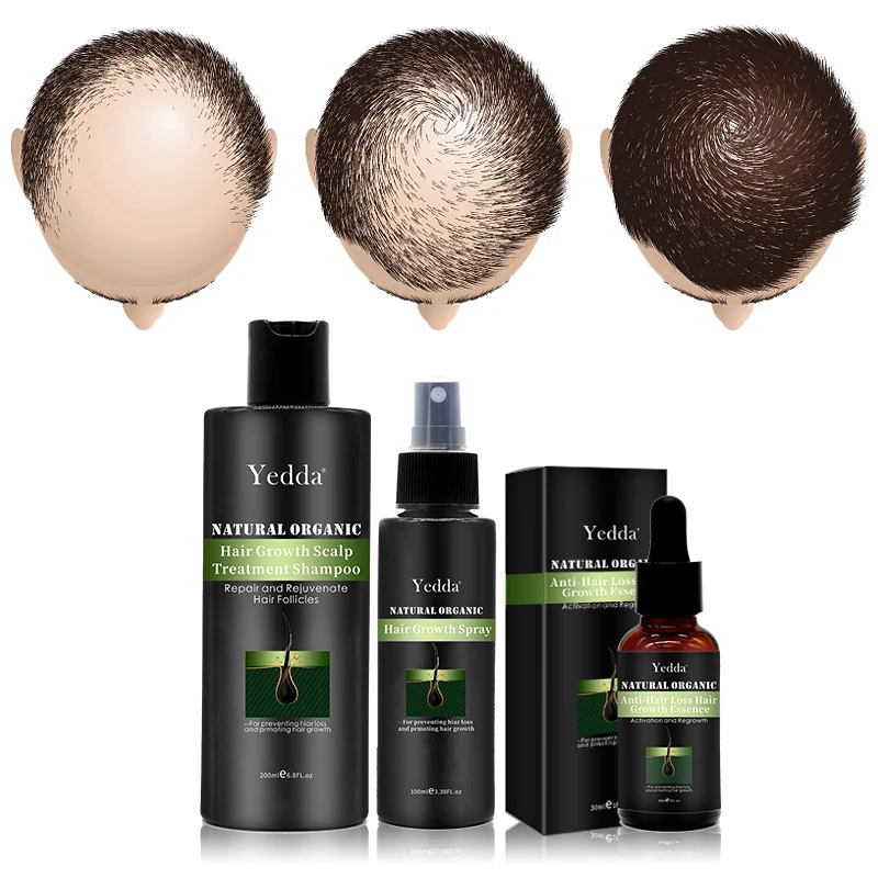 

Herbal Formula Effective Hair Growth Spray for Regrow Hair on Baldness Area, Light brown
