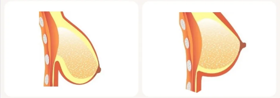 
Enhancement Women Full Elasticity Chest Care Breast Tightening Cream 