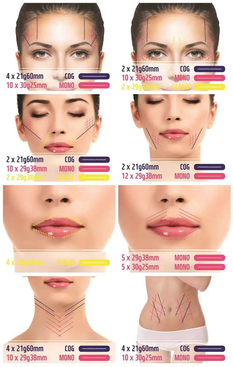 ELF LINE high quality pdo thread lift korea face lifting aptos thread lift META pdo