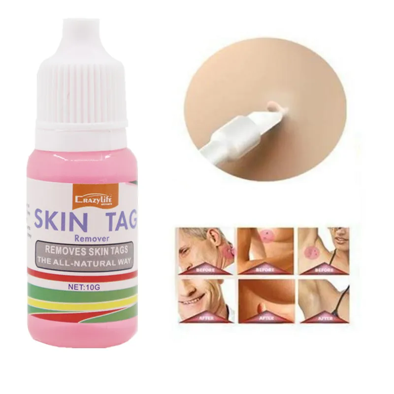 

crazylife 10ml Body Remove warts from skin liquid Skin repair solution Corns to remove skin tag