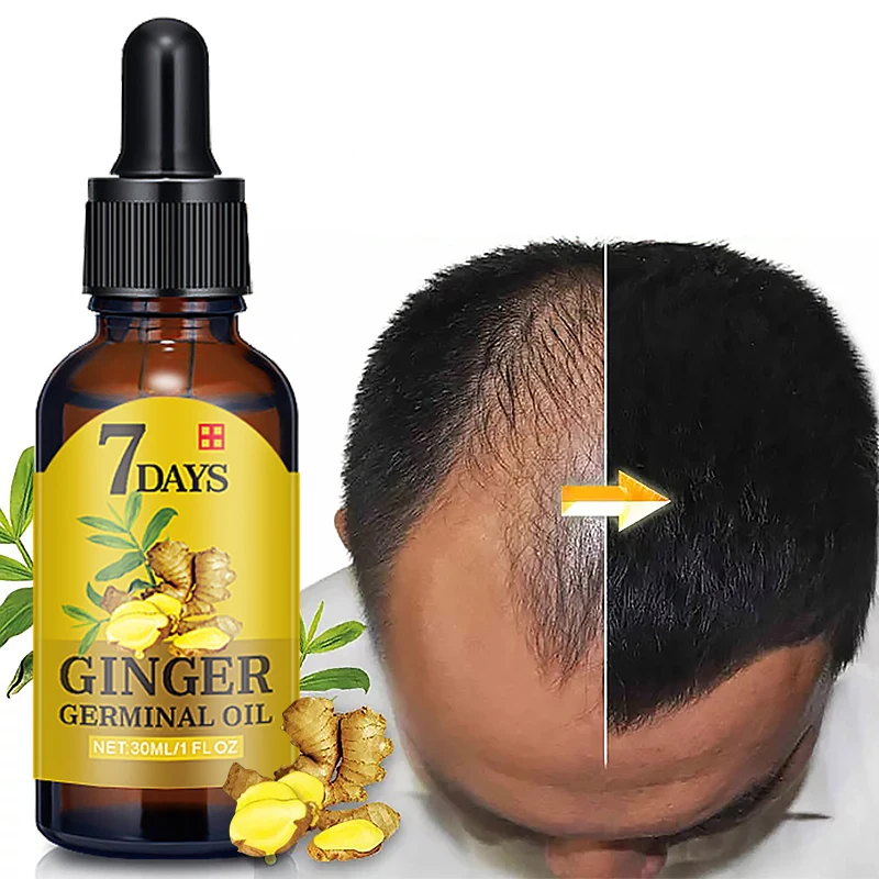 

7 Days Ginger Germinal Oil 2020 Bald Hair Growth Products for Men Women