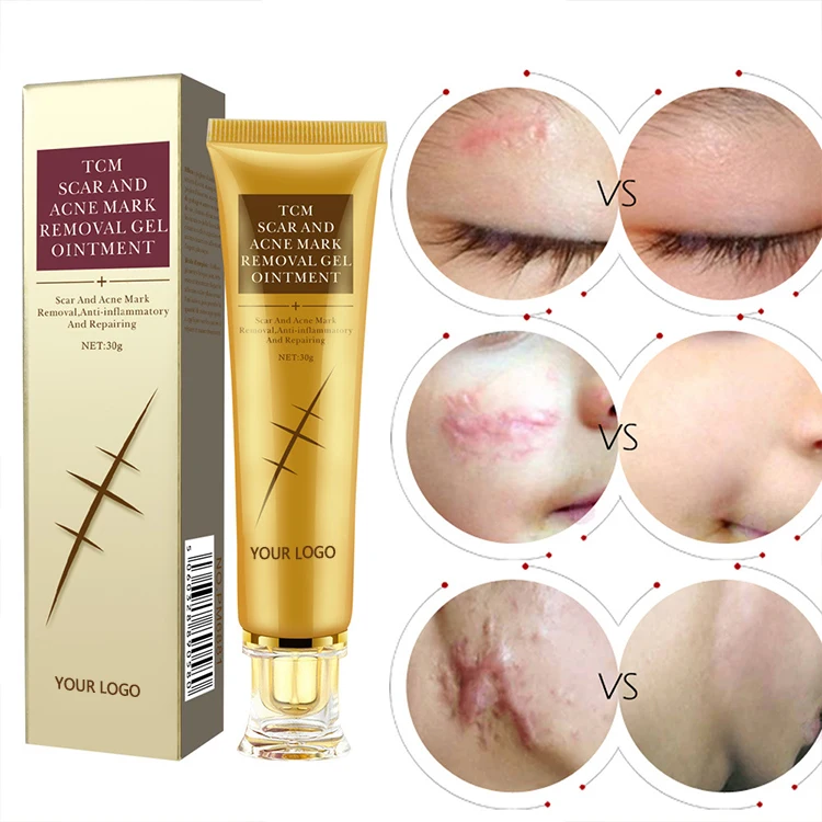 

Organic Strong Removal Redness Scar Spot Skin Whitening Cream Natural Moisturizing Cream Whitening Skin Body Face Cream