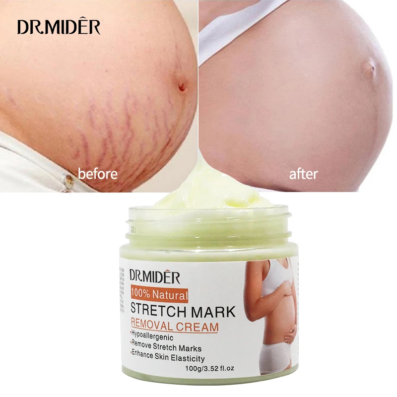 

Safe Effective Repair Pregnancy Scars Acne Surgery Scar Anti-aging Anti Winkles Firming Body Creams Removal Stretch Marks Cream