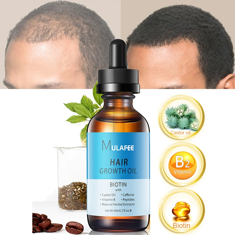 

Private Label Natural Organic Vegan Hair Treatment Wholesale Custom Herbal Anti Hair Loss Serum Biotin Hair Growth Oil