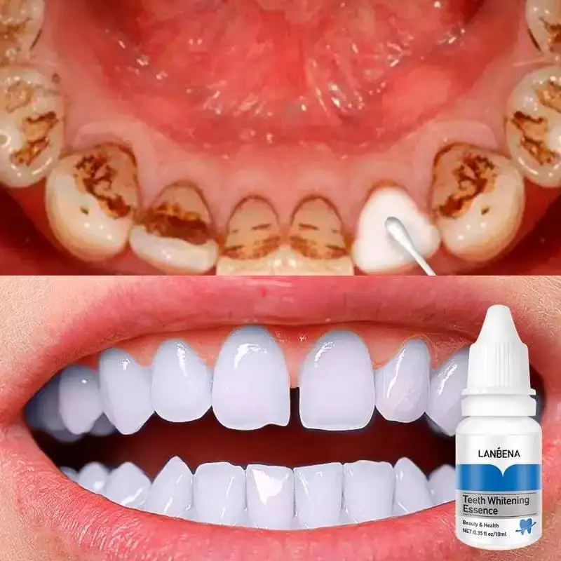 

Portable Teeth Whitening Essence Liquid Private Label Odm