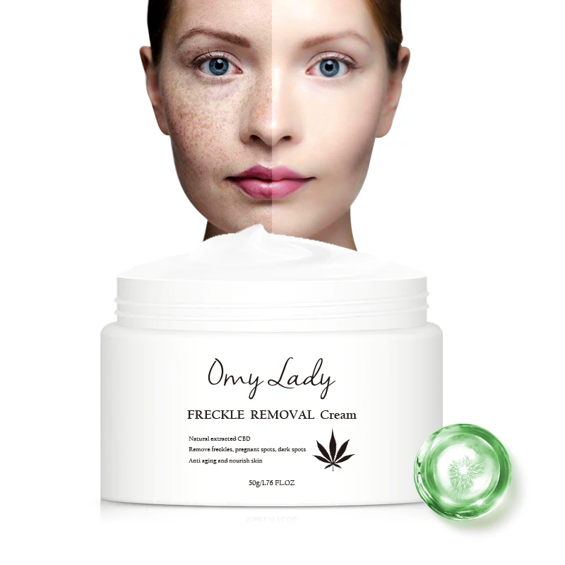 

Private label anti freckle mark removal cream face whitening freckles cover set