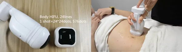 lipo